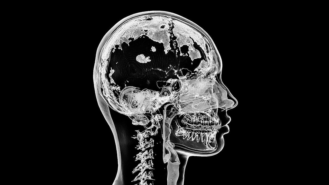 Computed tomography of the skull and neck